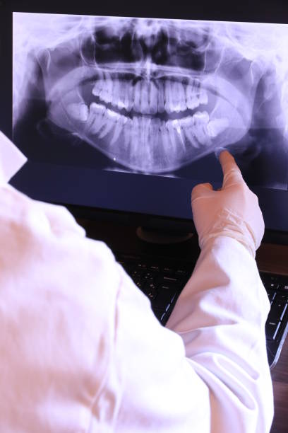 Best Knocked-Out Tooth (Avulsed Tooth) Treatment in Minden, NV